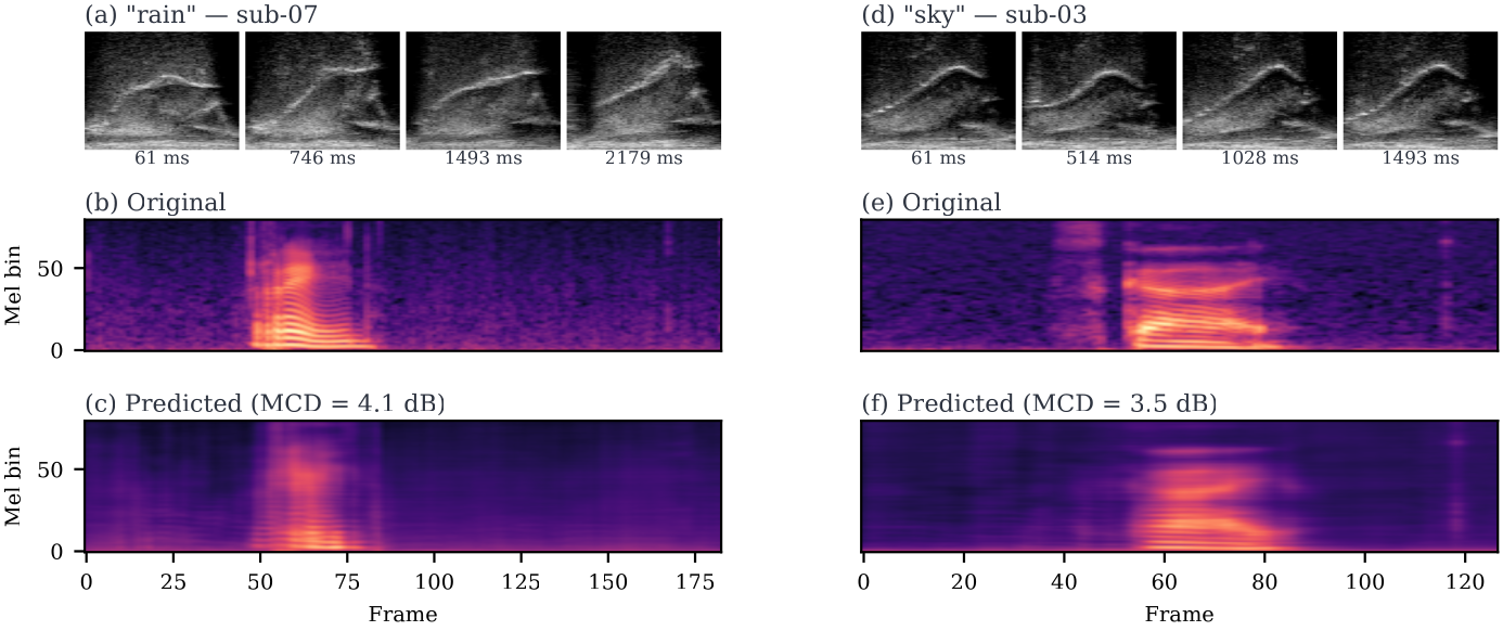 Two example utterances: rain (sub-07 ses-01) on the left, sky (sub-03 ses-01) on the right. Each shows four UTI frames (top), the original mel-spectrogram (middle), and the predicted mel-spectrogram (bottom).